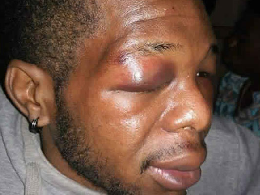 Tunisie : pour que notre pays ne soit pas une terre de racisme