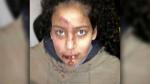 Vague de violences contre les étrangers en Allemagne: Des tunisiens victimes d'agressions de néo-nazis