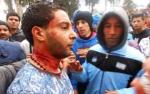 Tunisie ' Béja : Un protestataire tente de se suicider dans le siège du gouvernorat