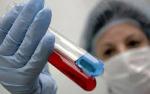 Epidémie de tuberculose à Monastir: Clarifications du ministère de la Santé