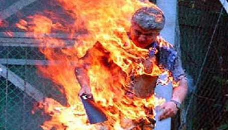في ألمانيا: طفل تونسي يسترجع وجهه بعد محاولة انتحار حرقا بقفصة في 2012